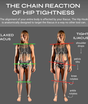 Hip Hook™ System (+ Orbit® & App)