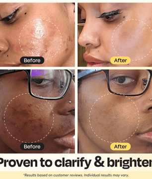 Vitamin C Clay Mask