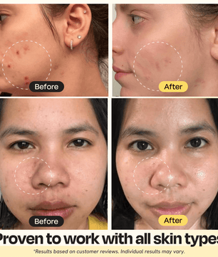 Vitamin C Clay Mask