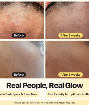 Advanced Brightening Moisturizer